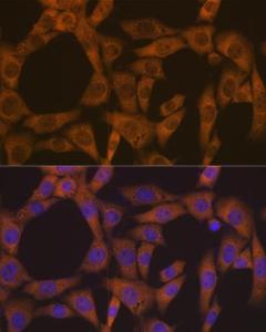 Immunofluorescence analysis of NIH-3T3 cells using Anti-CAD/BM1 Antibody [ARC1426] (A306805) at a dilution of 1:100 (40X lens). DAPI was used to stain the cell nuclei (blue)