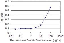 Anti-PHKG2 Mouse Monoclonal Antibody [clone: 2D12]