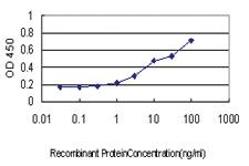 Anti-NADK Mouse Monoclonal Antibody [clone: 5F4]