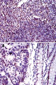 Anti-XRCC5 Mouse Monoclonal Antibody [clone: 5C5]