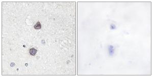 Immunohistochemical analysis of paraffin-embedded human brain using Anti-Aquaporin 2 (phospho Ser256) Antibody. The right hand panel represents a negative control, where the antibody was pre-incubated with the immunising peptide.