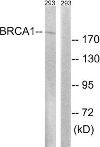 Western blot analysis of lysates from 293 cells treated with epo 20U/ml 15' using Anti-BRCA1 Antibody. The right hand lane represents a negative control, where the antibody is blocked by the immunising peptide