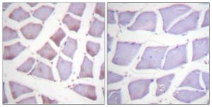 Immunohistochemical analysis of paraffin-embedded human skeletal muscle tissue using Anti-XIAP Antibody. The right hand panel represents a negative control, where the antibody was pre-incubated with the immunising peptide