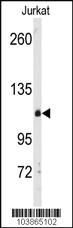 Anti-DGKD Rabbit Polyclonal Antibody