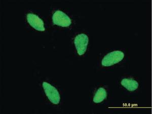 Anti-HIST2H2AA3 Mouse Monoclonal Antibody [clone: 4C10]