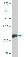 Anti-MTMR1 Mouse Monoclonal Antibody [clone: 1F10]