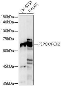 Western blot analysis of various lysates, using Anti-PCK2 Antibody (A306806) at 1:1,000 dilution The secondary antibody was Goat Anti-Rabbit IgG H&L Antibody (HRP) at 1:10,000 dilution Lysates/proteins were present at 25 µg per lane