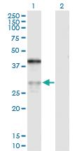 Anti-ASPH Rabbit Polyclonal Antibody