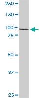 Anti-RFX6 Rabbit Polyclonal Antibody