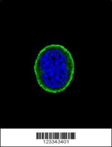 Anti-Interleukin 10 Receptor alpha Rabbit Polyclonal Antibody (HRP (Horseradish Peroxidase))