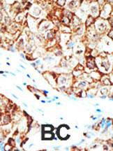 Anti-UBQLN1 Rabbit Polyclonal Antibody (AP (Alkaline Phosphatase))