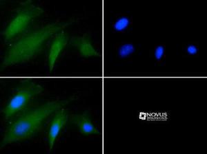 Anti-F12 Rabbit Polyclonal Antibody