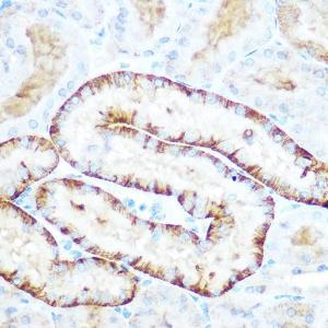 Immunohistochemistry analysis of paraffin-embedded mouse kidney using Anti-PCK2 Antibody (A306806) at a dilution of 1:100 (40x lens) Perform microwave antigen retrieval with 10 mM Tris/EDTA buffer pH 90 before commencing with IHC staining protocol