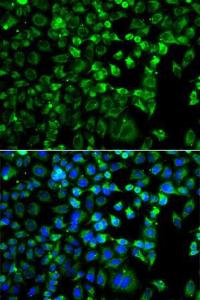 Immunofluorescence analysis of A549 cells using Anti-ZAK Antibody (A12109). DAPI was used to stain the cell nuclei (blue).