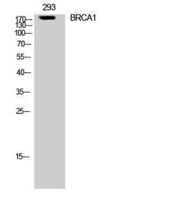 Western blot analysis of 293 cells using Anti-BRCA1 Antibody