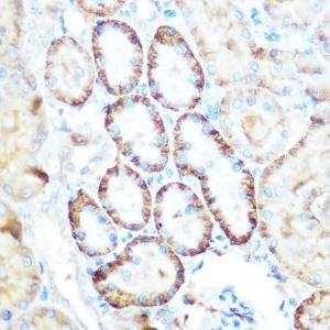 Immunohistochemistry analysis of paraffin-embedded rat kidney using Anti-PCK2 Antibody (A306806) at a dilution of 1:100 (40x lens) Perform microwave antigen retrieval with 10 mM Tris/EDTA buffer pH 90 before commencing with IHC staining protocol