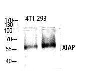 Western blot analysis of various cells using Anti-XIAP Antibody