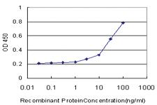 Anti-PHKG2 Mouse Monoclonal Antibody [clone: 2B4]