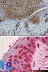 Anti-HMGB1 Mouse Monoclonal Antibody [clone: 19N15F4]