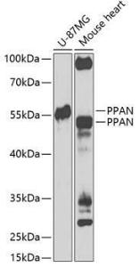 Western blot analysis of extracts of various cell lines, using Anti-PPAN Antibody (A12111) at 1:1000 dilution. The secondary Antibody was Goat Anti-Rabbit IgG H&L Antibody (HRP) at 1:10000 dilution. Lysates/proteins were present at 25 µg per lane