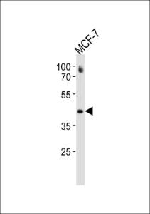 Anti-ESR2 Rabbit Polyclonal Antibody (Biotin)