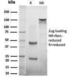 SDS-PAGE analysis of Anti-CTBP2 Antibody [PCRP-CTBP2-1A9] under non-reduced and reduced conditions; showing intact IgG and intact heavy and light chains, respectively SDS-PAGE analysis confirms the integrity and purity of the antibody