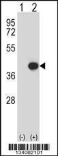 Anti-CEBPE Rabbit Polyclonal Antibody (FITC (Fluorescein Isothiocyanate))