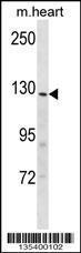 Anti-INSRR Rabbit Polyclonal Antibody (HRP (Horseradish Peroxidase))