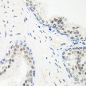 Immunohistochemistry analysis of paraffin-embedded human prostate using Anti-PPAN Antibody (A12111) at a dilution of 1:200 (40X lens). Perform microwave antigen retrieval with 10 mM PBS buffer pH 7.2 before commencing with IHC staining protocol