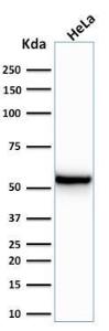 Western blot analysis of human HeLa cell lysate using Anti-Cytokeratin 7 Antibody [KRT7/760]