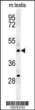 Anti-STAMBPL1 Rabbit Polyclonal Antibody