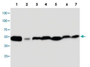 Anti-MAPK8 Rabbit Polyclonal Antibody