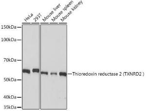 Anti-TXNRD2 Rabbit Monoclonal Antibody [clone: ARC1339]