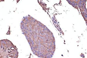 Immunohistochemistry analysis of paraffin-embedded mouse testis using Anti-PD-L1 Antibody (A308021) at a dilution of 1:100 (40x lens). Perform microwave antigen retrieval with 10 mM PBS buffer pH 7.2 before commencing with IHC staining protocol