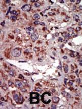 Anti-DGKA Rabbit Polyclonal Antibody