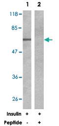 Anti-RPS6KB1 Rabbit Polyclonal Antibody