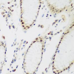 Immunohistochemistry analysis of paraffin-embedded human stomach using Anti-PPAN Antibody (A12111) at a dilution of 1:200 (40X lens). Perform microwave antigen retrieval with 10 mM PBS buffer pH 7.2 before commencing with IHC staining protocol