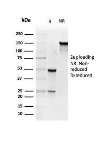 SDS-PAGE analysis of Anti-Resistin Antibody [RETN/4327] under non-reduced and reduced conditions; showing intact IgG and intact heavy and light chains, respectively. SDS-PAGE analysis confirms the integrity and purity of the antibody