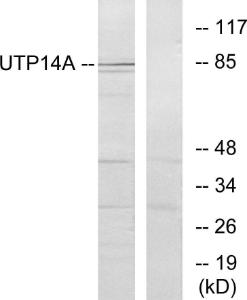 Western blot analysis of lysates from HeLa cells using Anti-UTP14A Antibody. The right hand lane represents a negative control, where the antibody is blocked by the immunising peptide