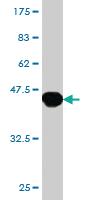 Anti-HOXB13 Mouse Monoclonal Antibody [clone: 1E9]