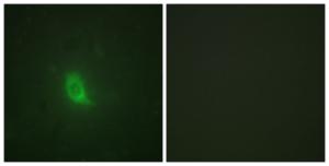 Immunofluorescence analysis of HUVEC cells using Anti-SEPARASE (phospho Ser801) Antibody. The right hand panel represents a negative control, where the antibody was pre-incubated with the immunising peptide.