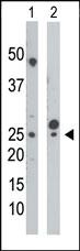 Anti-UCK1 Rabbit Polyclonal Antibody