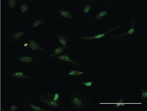 Anti-ASS1 Mouse Monoclonal Antibody [clone: 2D2]