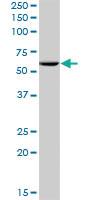 Anti-PES1 Mouse Polyclonal Antibody