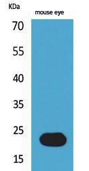 Anti-BNIP3 Rabbit Polyclonal Antibody