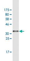 Anti-ZFP161 Mouse Monoclonal Antibody [clone: 4F7]