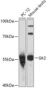 Western blot analysis of extracts of various cell lines, using Anti-GK2 Antibody (A306809) at 1:1,000 dilution. The secondary antibody was Goat Anti-Rabbit IgG H&L Antibody (HRP) at 1:10,000 dilution.