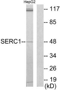 Western blot analysis of lysates from HepG2 cells using Anti-SERC1 Antibody. The right hand lane represents a negative control, where the antibody is blocked by the immunising peptide