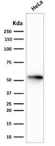 Western blot analysis of human HeLa cell lysate using Anti-Cytokeratin 7 Antibody [rOV-TL12/30]