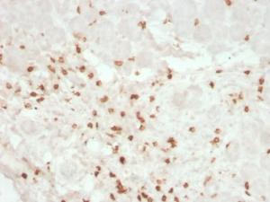 Immunohistochemical analysis of formalin-fixed, paraffin-embedded human colon using Anti-CD8A Antibody [rC8/468]